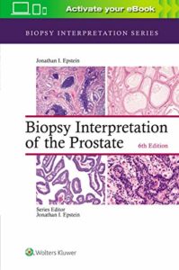Biopsy Interpretation of the Prostate (Biopsy Interpretation Series) 6th Edition