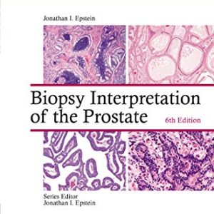 Biopsy Interpretation of the Prostate (Biopsy Interpretation Series) 6th Edition
