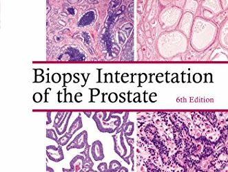 Biopsy Interpretation of the Prostate (Biopsy Interpretation Series) 6th Edition