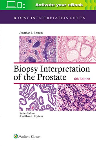 Biopsy Interpretation of the Prostate (Biopsy Interpretation Series) 6th Edition by Jonathan I. Epstein (Author)