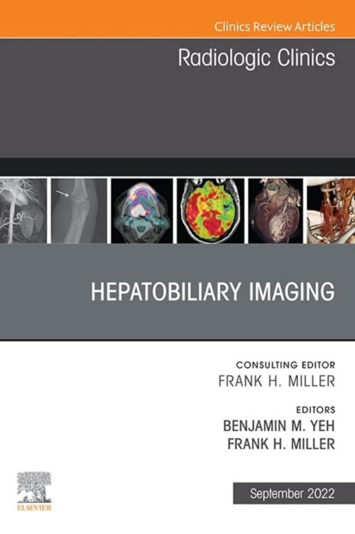 Hepatobiliary Imaging, An Issue of Radiologic Clinics of North America, E-Book (Volume 60-5)(The Clinics: Internal Medicine)