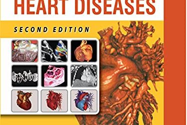 A Comprehensive Approach to Congenital Heart Diseases 2nd Edition
