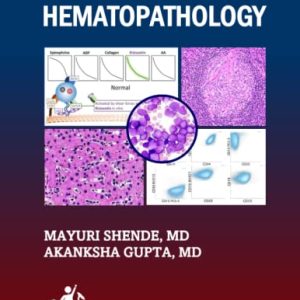 Ace The Boards: A Concise Textbook of Hematopathology (Ace My Path) [Print Replica]