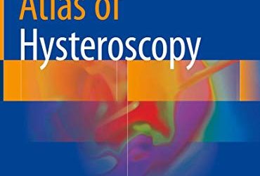 Atlas of Hysteroscopy 1st ed. 2020 Edition