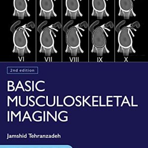 Basic Musculoskeletal Imaging, Second Edition (Original PDF from Publisher)