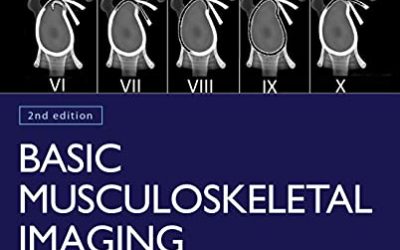 Basic Musculoskeletal Imaging, Second Edition 2nd Edition