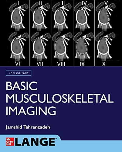 Basic Musculoskeletal Imaging, Second Edition (Original PDF from Publisher)