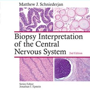 Biopsy Interpretation of the Central Nervous System (Biopsy Interpretation Series) 2nd Edition