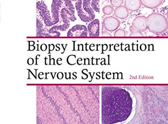 Biopsy Interpretation of the Central Nervous System (Biopsy Interpretation Series) 2nd Edition