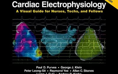 Cardiac Electrophysiology: A Visual Guide for Nurses, Techs, and Fellows, 2nd Edition