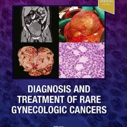 Diagnosis and Treatment of Rare Gynecologic Cancers, 1st Edition - E-Book - Original PDF