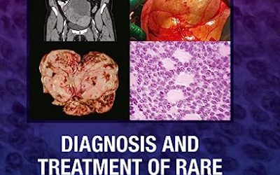 Diagnosis and Treatment of Rare Gynecologic Cancers 1st Edition