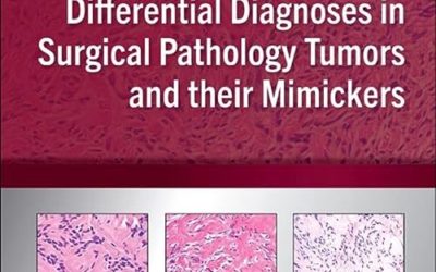 Differential Diagnoses in Surgical Pathology Tumors and their Mimickers: A Volume in the Foundations in Diagnostic Pathology series 1st Edition