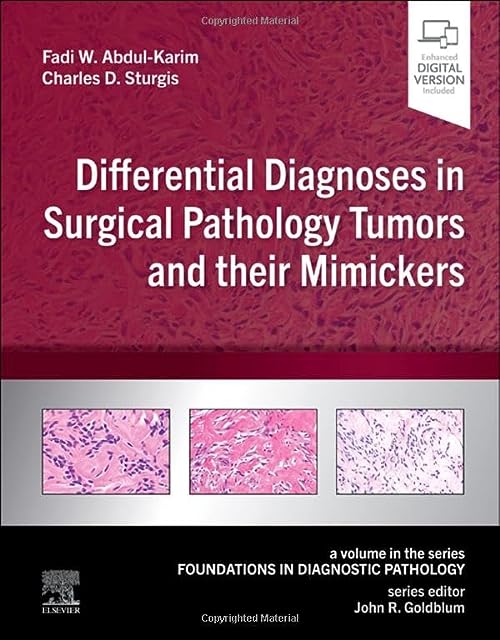 Diagnósticos diferenciais em tumores de patologia cirúrgica e seus imitadores: um volume da série Foundations in Diagnostic Pathology 1ª edição