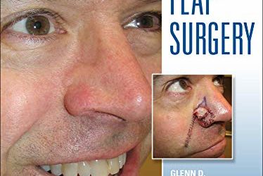 Facial Flaps Surgery 1st Edition
