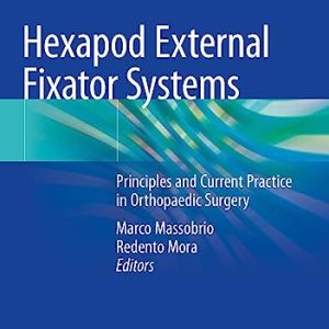 Hexapod External Fixator Systems: Principles and Current Practice in Orthopaedic Surgery 1st ed. 2021 Edition