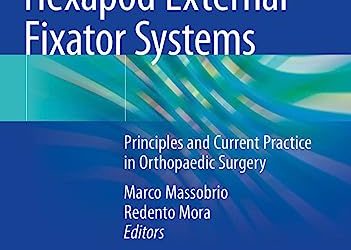 Hexapod External Fixator Systems: Principles and Current Practice in Orthopaedic Surgery 1st ed. 2021 Edition