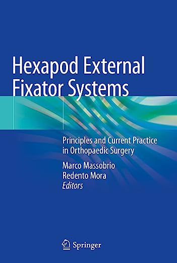 Hexapod External Fixator Systems: Principles and Current Practice in Orthopaedic Surgery 1st ed. 2021 Edition