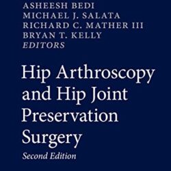 Hip Arthroscopy and Hip Joint Preservation Surgery 2nd ed. 2022 Edition