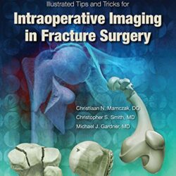 Illustrated Tips and Tricks for Intraoperative Imaging in Fracture Surgery First Edition by Michael J. Gardner MD (Author)