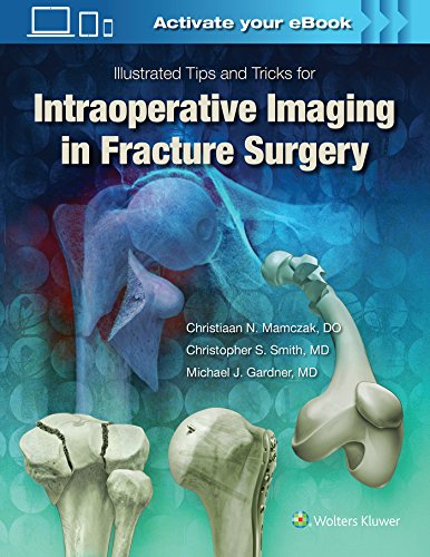 Illustrated Tips and Tricks for Intraoperative Imaging in Fracture Surgery First Edition by Michael J. Gardner MD (Author)