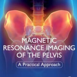 Magnetic Resonance Imaging (MRI) of The Pelvis: A Practical Approach 1st Edition