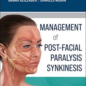 Management of Post-Facial Paralysis Synkinesis