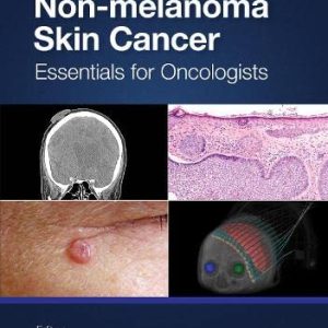 Non-melanoma Skin Cancer: Essentials for Oncologists  1st Edition