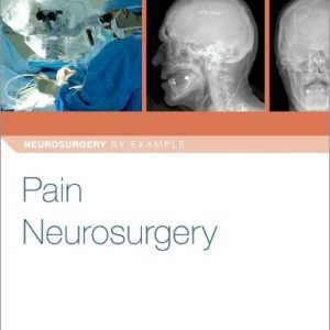 Pain Neurosurgery (Neurosurgery by Example) 1st Edition