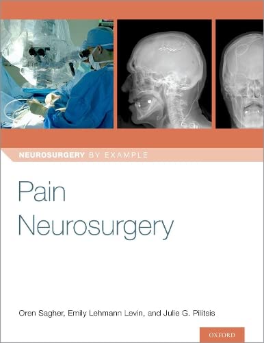 Pain Neurosurgery (Neurosurgery by Example) 1st Edition