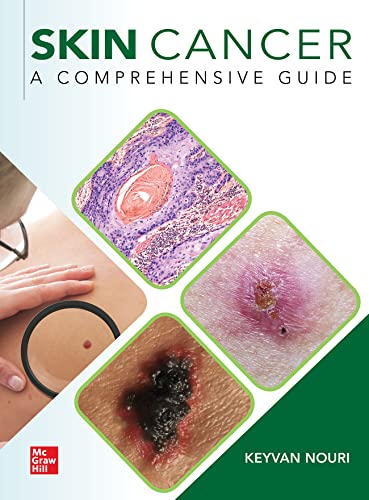 Skin Cancer: A Comprehensive Guide 1st Edition