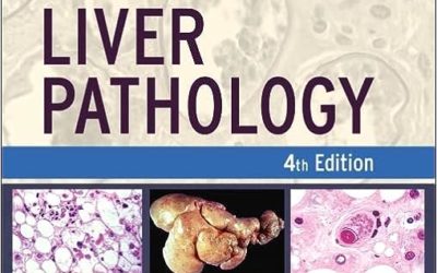 Atlas of Liver Pathology (Atlas of Surgical Pathology) 4th Edition