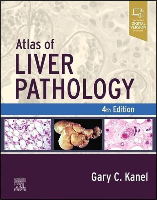 Atlas of Liver Pathology (Atlas of Surgical Pathology) 4th Edition