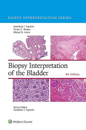 Biopsy Interpretation of the Bladder (Biopsy Interpretation Series) Fourth Edition