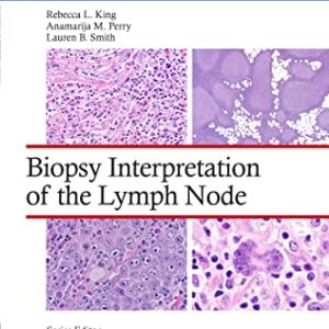 Biopsy Interpretation of the Lymph Node (Biopsy Interpretation Series) First Edition