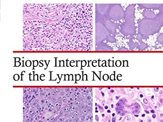 Biopsy Interpretation of the Lymph Node (Biopsy Interpretation Series) First Edition