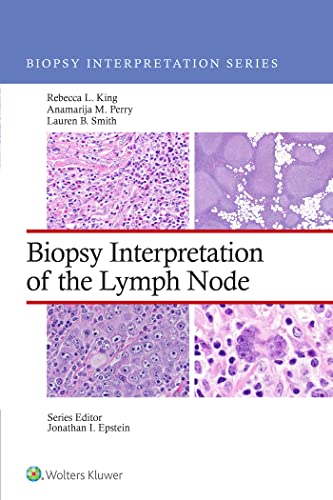 Biopsy Interpretation of the Lymph Node (Biopsy Interpretation Series) First Edition