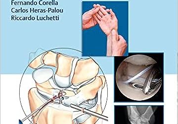 Carpal Ligament Injuries and Instability: FESSH Instructional Course Book 2023
