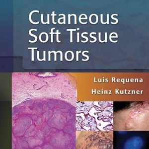 Cutaneous Soft Tissue Tumors by Luis Requena, Heinz Kutzner