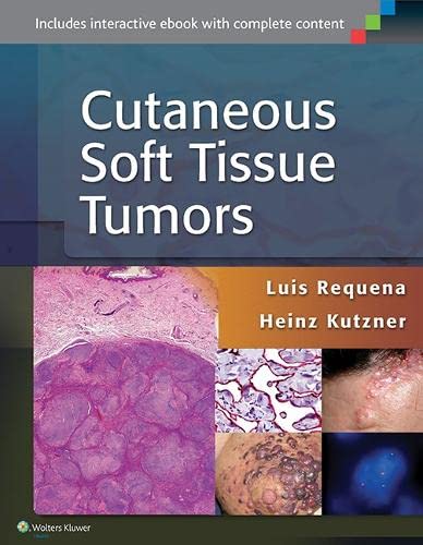 Cutaneous Soft Tissue Tumors by Luis Requena, Heinz Kutzner