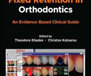 Debonding and Fixed Retention in Orthodontics: An Evidence-Based Clinical Guide, 1st Edition