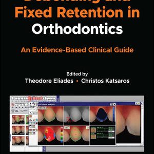 Debonding and Fixed Retention in Orthodontics: An Evidence-Based Clinical Guide, 1st Edition