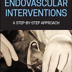 Endovascular Interventions a Step By step Approach