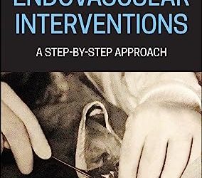 Endovascular Interventions: A Step-by-Step Approach