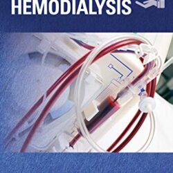 Handbook of Home Hemodialysis 1st Edition
