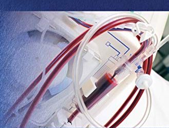Handbook of Home Hemodialysis 1st Edition
