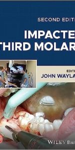 Impacted Third Molars, 2nd Edition - E-Book - Original PDF