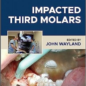 Impacted Third Molars, 2nd Edition – E-Book – Original PDF