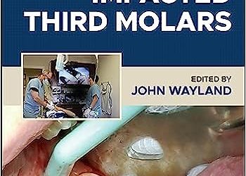 Impacted Third Molars, 2nd Edition – E-Book – Original PDF