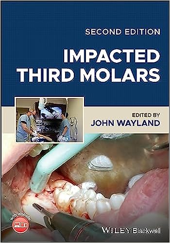 Impacted Third Molars, 2nd Edition - E-Book - Original PDF